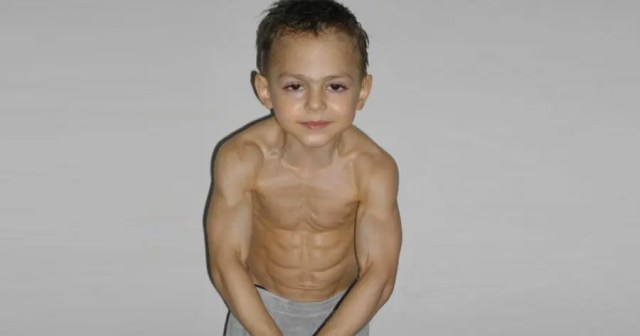 Unvaccinated Muscle-Child Going for Glass Cannon Build