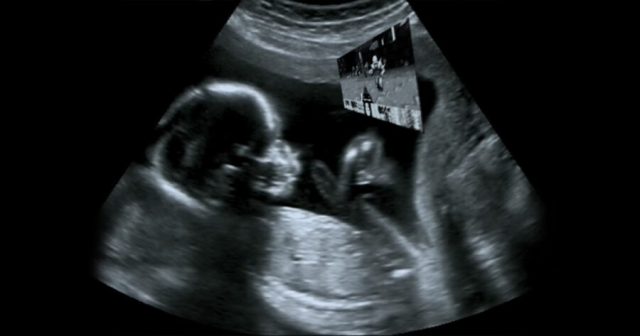 Pretty Neat: This Hacked Ultrasound Machine Will Let Your Fetus Play Doom