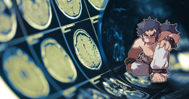 Report: Pokémon League Suppressed Concussion Research